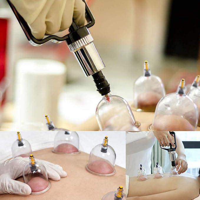 MUCHOO Cupping Set Professional Chinese Acupoint Cupping Therapy Sets Portable, Suction Hijama Cupping Set with Vacuum Magnetic Pump Cellulite Cupping Massage Kit 22-Cup