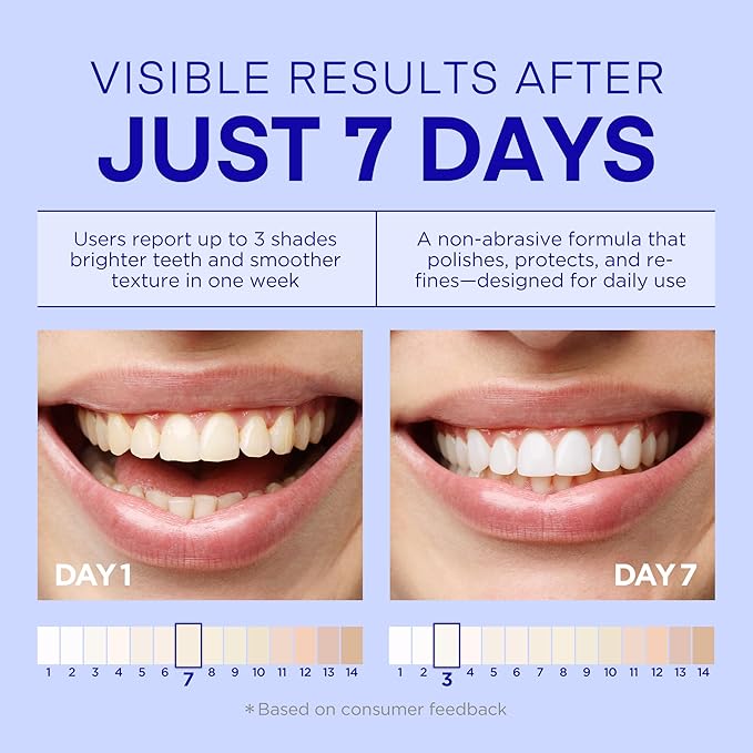 PearlSmile Niacinamide Hydroxyapatite Whitening Toothpaste – 10% Nano Hydroxyapatite + 5% Niacinamide – Strengthens Enamel, Remineralizes, Brightens Teeth – Fluoride-Free, Travel Size, 4.2oz (120g)