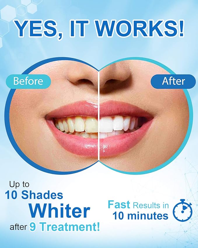 MySmile Non-Sensitive Teeth Whitening Pen Mint Gel Enamel Safety 8ML 30+ Treatments Fast Remove 20 Years of Stains Care Oral Bright Smile Alternative Teeth Whitening Strips 