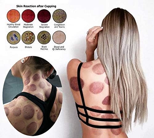 MUCHOO Cupping Set Professional Chinese Acupoint Cupping Therapy Sets Portable, Suction Hijama Cupping Set with Vacuum Magnetic Pump Cellulite Cupping Massage Kit 22-Cup
