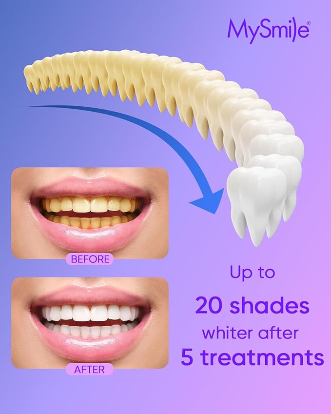 MySmile 4Pcs 35% Non-Sensitive Teeth Whitening Gel Refill Pack Kit for Whitening Teeth - Effective Painless Carbamide Peroxide Enamel Safety Mint Flavor Teeth Whitener(Not Include LED Mouth Tray)