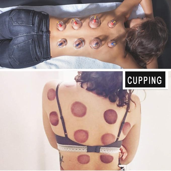 MUCHOO Cupping Set Professional Chinese Acupoint Cupping Therapy Sets Portable, Suction Hijama Cupping Set with Vacuum Magnetic Pump Cellulite Cupping Massage Kit 22-Cup