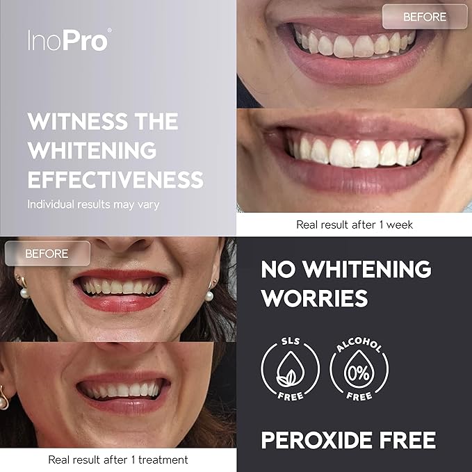 Natural Teeth Whitening Strips Kit 21 Treatments - Sensitive Teeth Whitener, Peroxide Free, Enamel Safe White Strips - Instant Teeth Whitening Without The Harm (42 Strips)